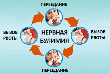 Лечение булимии в Мостовском